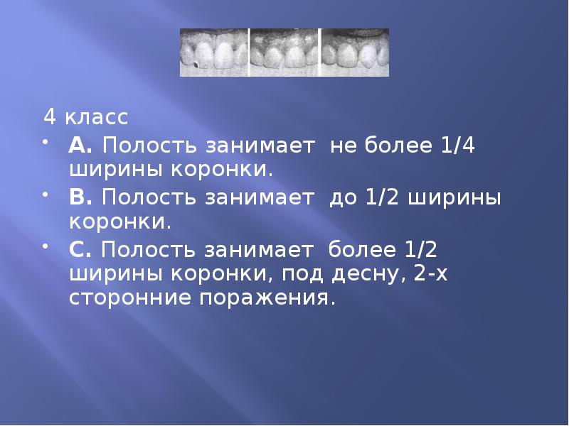 4 класс 4 класс А. Полость занимает не более 1/4 ширины