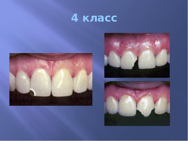 4 класс