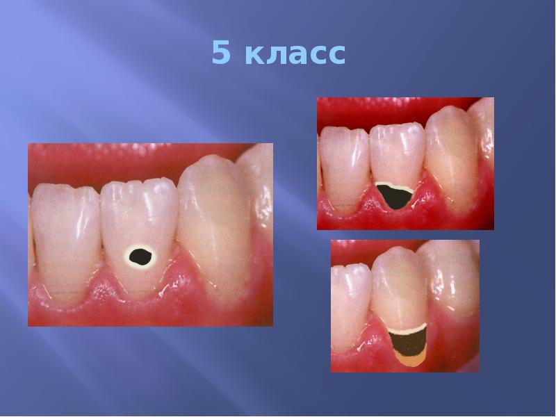 5 класс