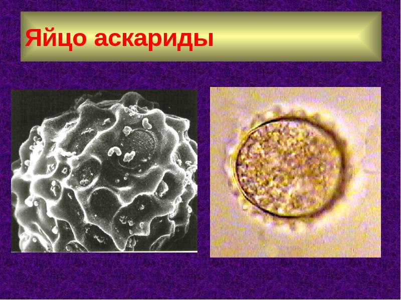 Нематода под микроскопом фото