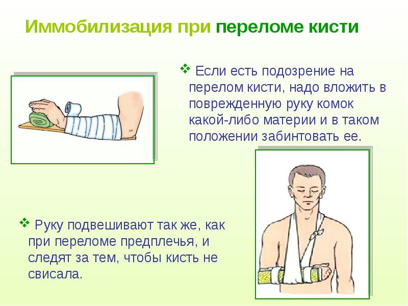 Как правильно спать при переломе плеча картинки