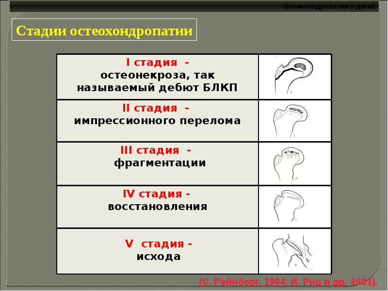 Остеохондропатии у детей презентация