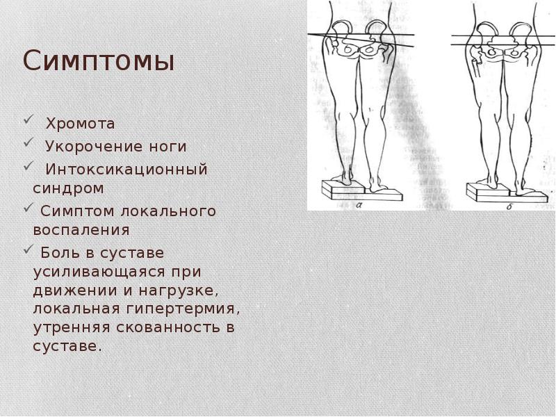 Симптомы
Хромота
Укорочение ноги
Интоксикационный синдром
Симптом Симптомы
Хромота
Укорочение ноги
Интоксикационный синдром
Симптом