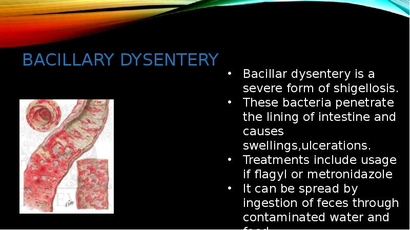 BACILLARY DYSENTERY BACILLARY DYSENTERY