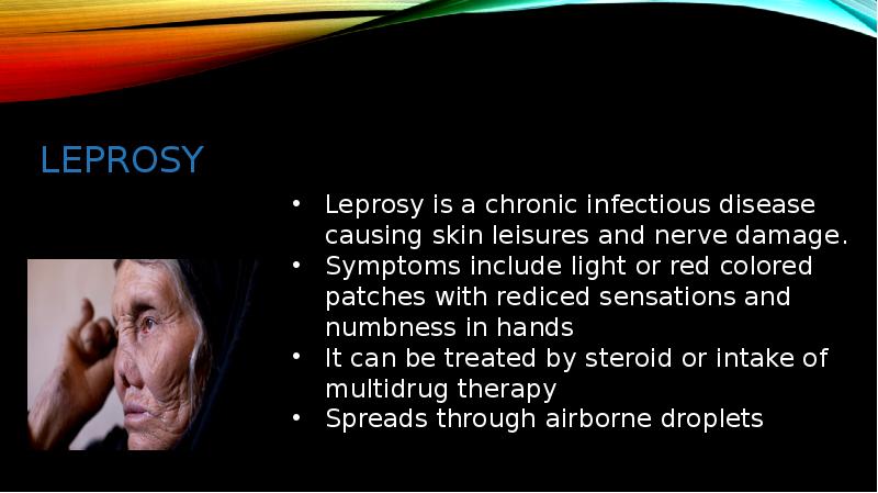 Leprosy Leprosy
