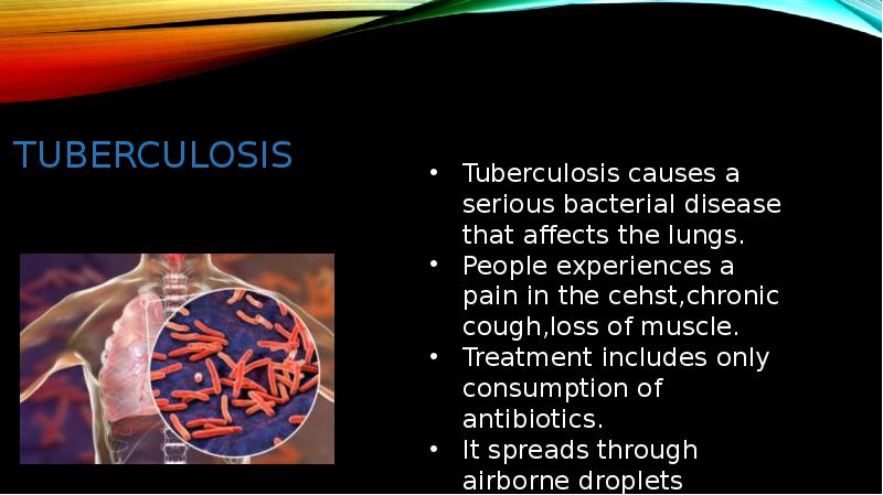 TUBERCULOSIS TUBERCULOSIS