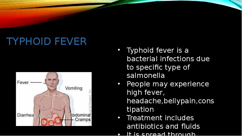 TYPHOID fever TYPHOID fever