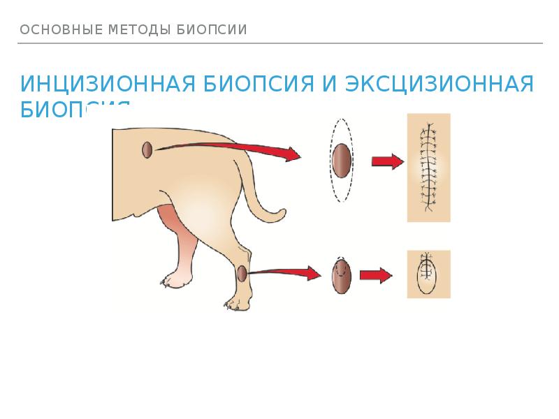 Инцизионная эксцизионная биопсия презентация