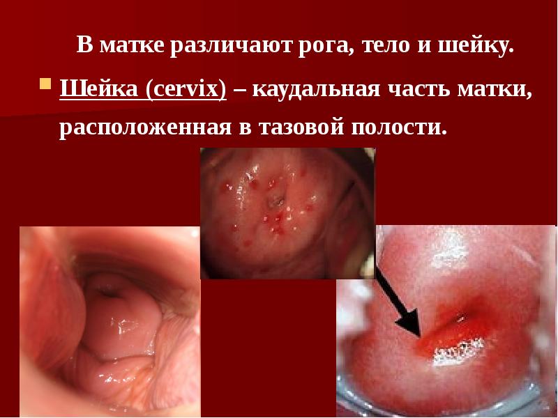 В матке различают рога, тело и шейку.    В