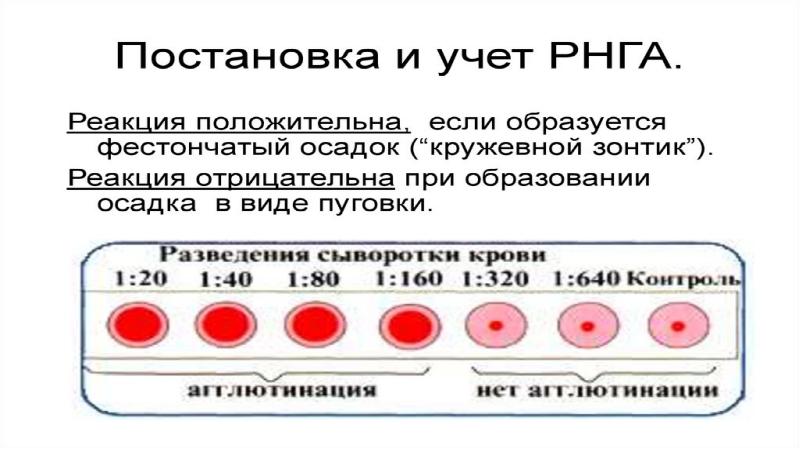 Реакция вассермана. Серологические реакции реакция Вассермана. Серологический метод РНГА. Реакция Вассермана презентация. Реакция Вассермана микробиология.