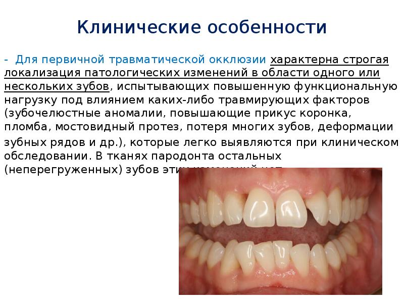 Презентация пародонтит локализованный