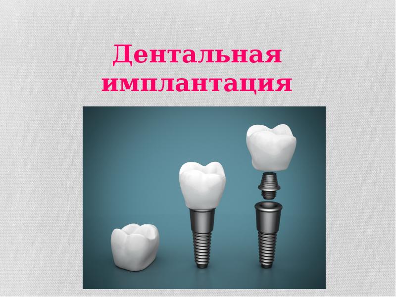 Анатомические предпосылки стоматологической имплантации презентация