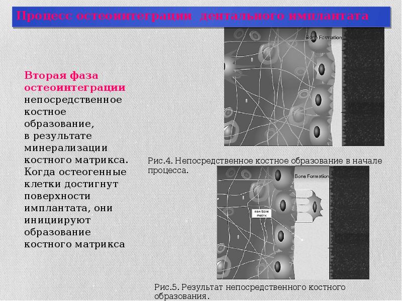 Остеоинтеграция имплантата презентация