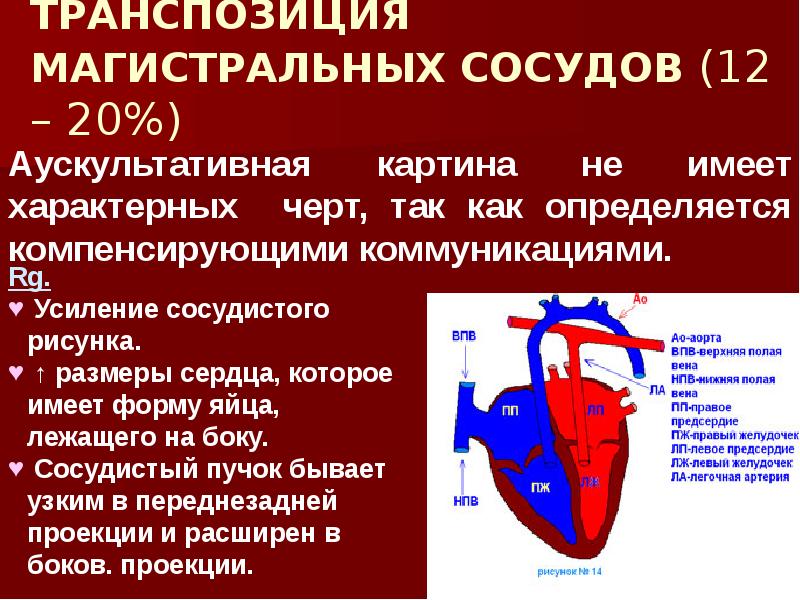 Транспозиция магистральных артерий презентация