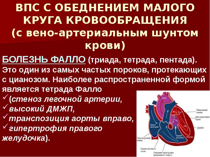 Сколько живут с пороком сердца врожденным