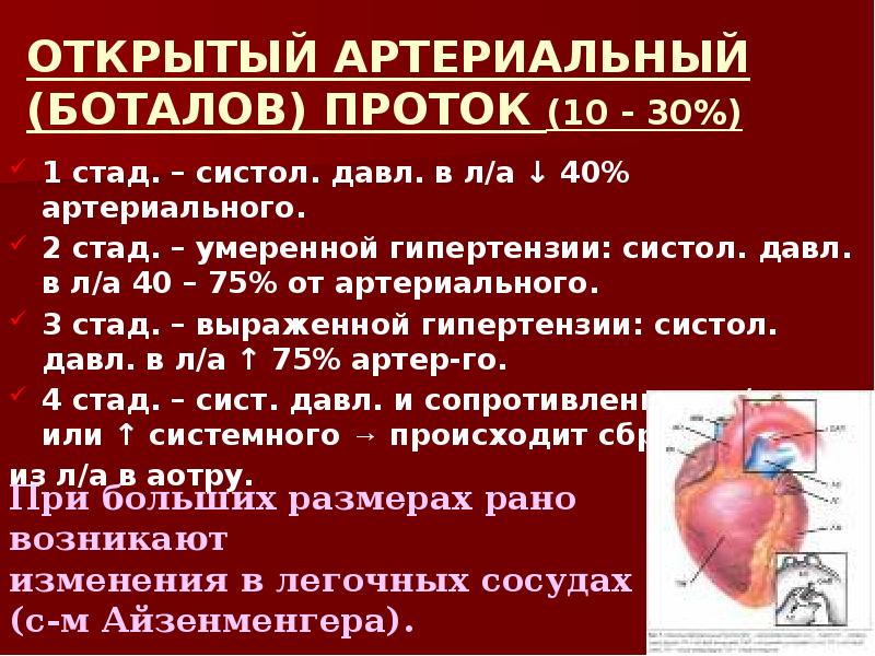 Открытый артериальный проток презентация