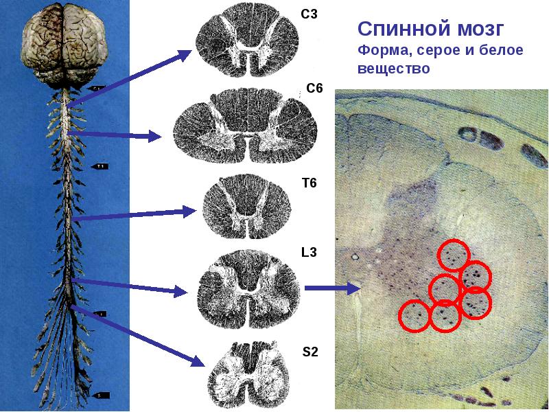 Вегетативный мозг это. Вегетативный мозг. Спинномозговой и вегетативный узел отличия. Вегетативный ганглий белое вещество препарат.