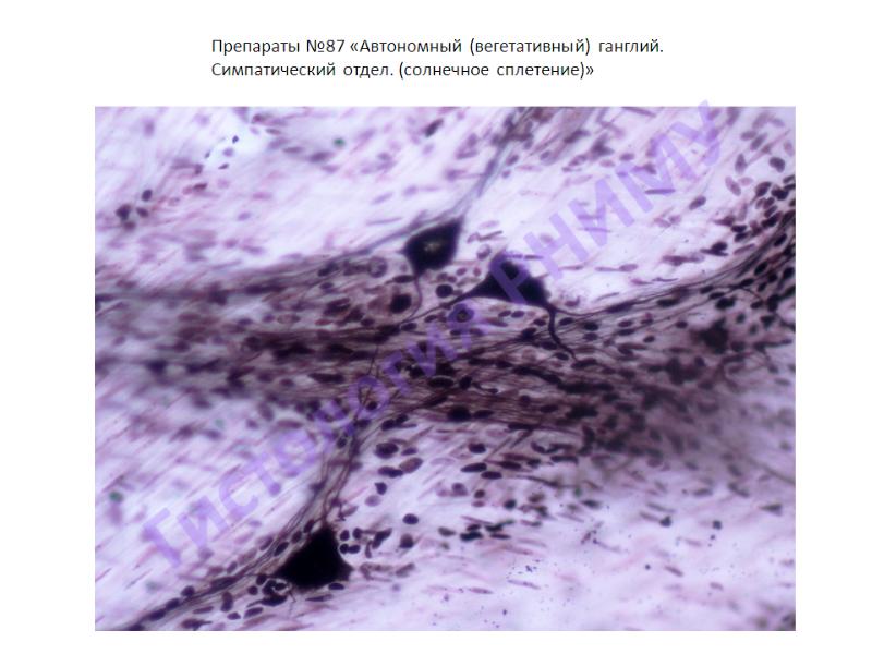 Интрамуральный ганглий гистология рисунок