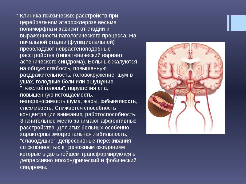 Церебральный атеросклероз карта вызова скорой медицинской