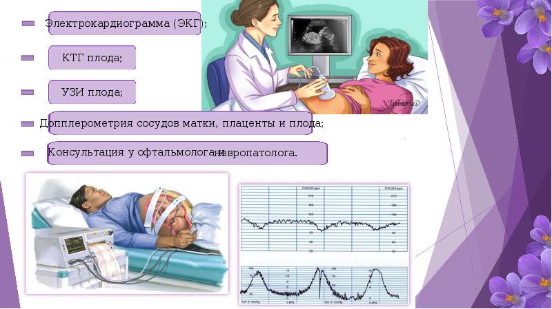 Презентация преэклампсия и эклампсия беременных