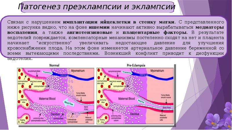 Презентация эклампсия беременных