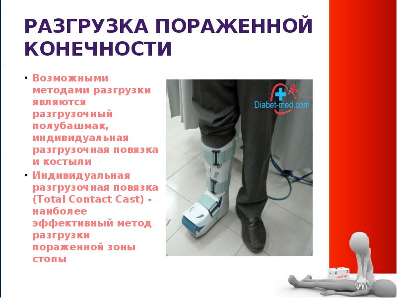 Поздние осложнения СД. Синдром диабетической стопы