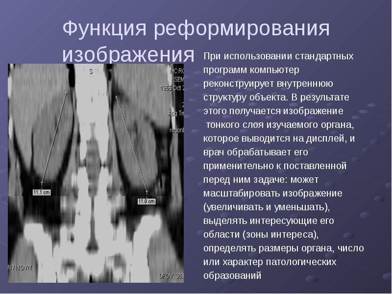 Лучевая диагностика почек презентация