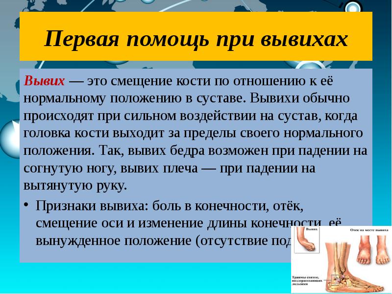 Что делать при вывихе. Первая помощь при вывихе. Первая помощь првывихах. Вывих оказание первой помощи. Оказание первой помощи при вывихе сустава.