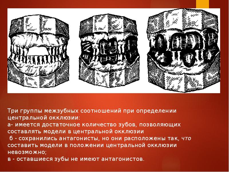 Определение центрального соотношения челюстей при полном отсутствии зубов презентация