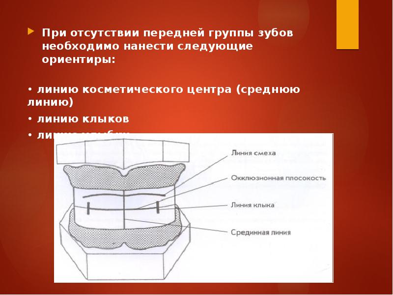 Определение центральной окклюзии