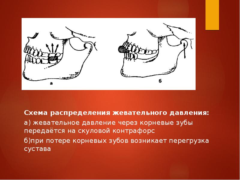 Определение центрального соотношения челюстей при полном отсутствии зубов презентация