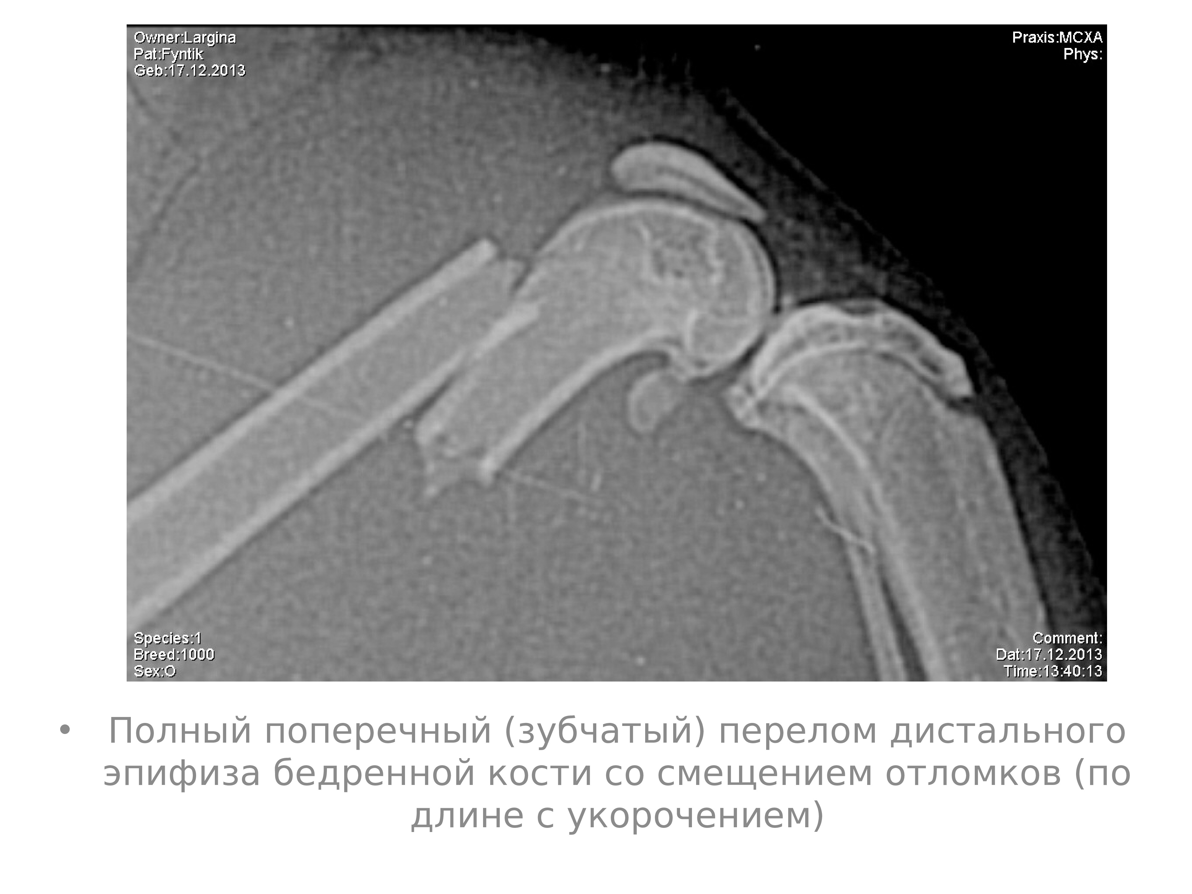 Заживление переломов презентация