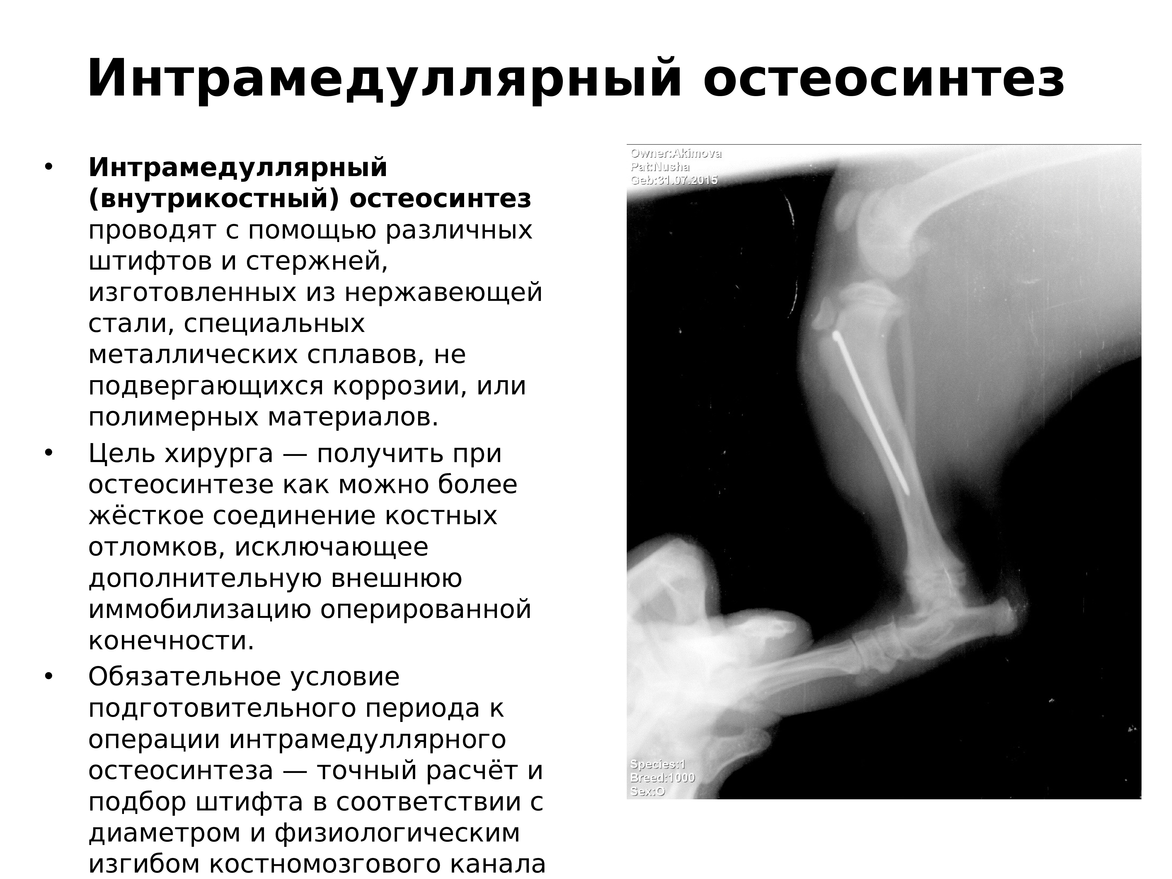 Образец описания рентгенограммы перелома