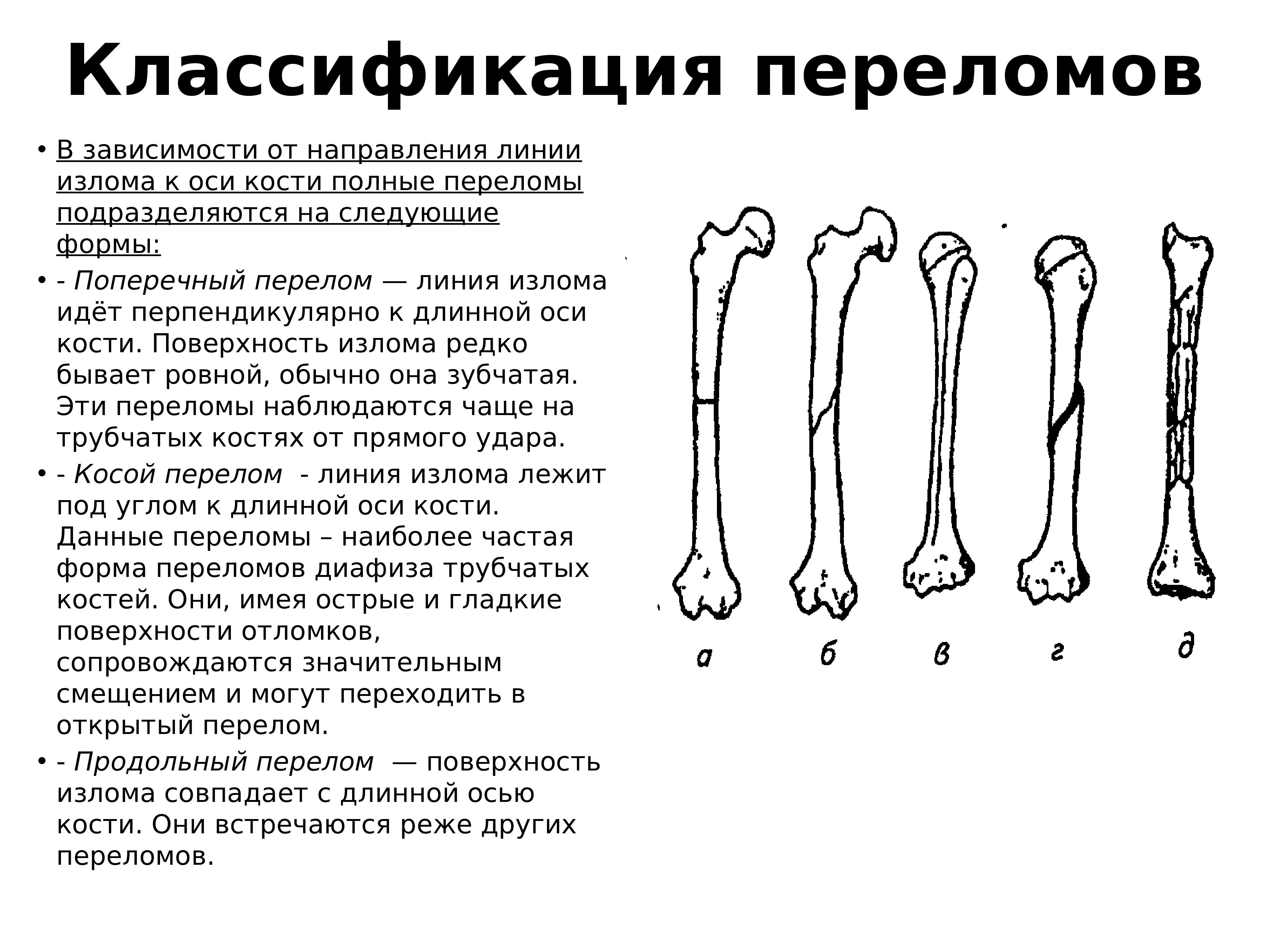 Виды переломов картинки