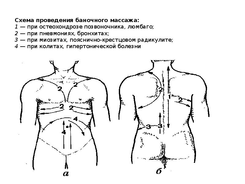 Антицеллюлитный массаж схема выполнения