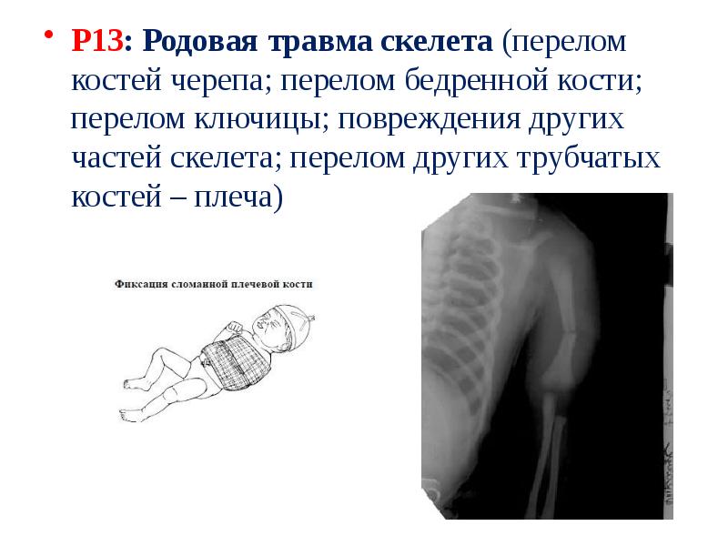 Родовой травматизм презентация