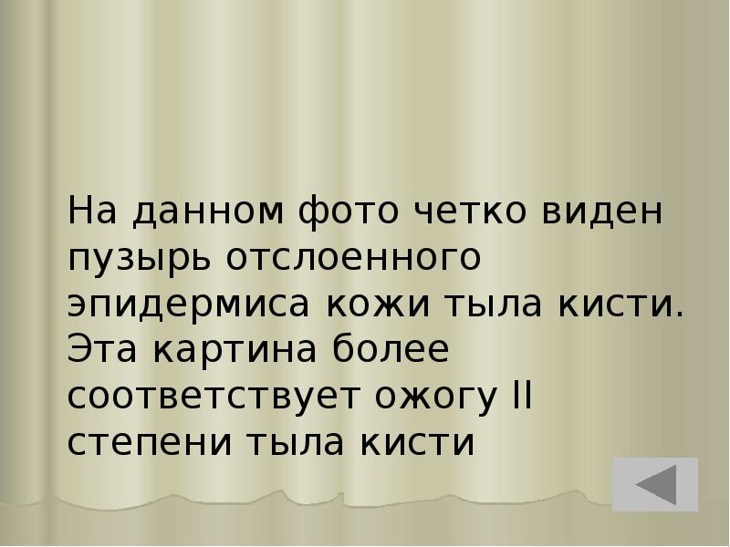 На данном фото четко виден пузырь отслоенного эпидермиса кожи тыла кисти. На данном фото четко виден пузырь отслоенного эпидермиса кожи тыла кисти.