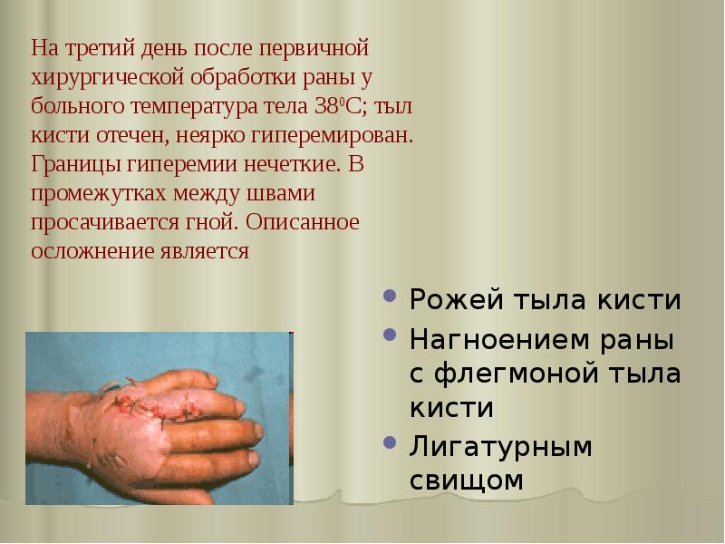 На третий день после первичной хирургической обработки раны у больного температура На третий день после первичной хирургической обработки раны у больного температура