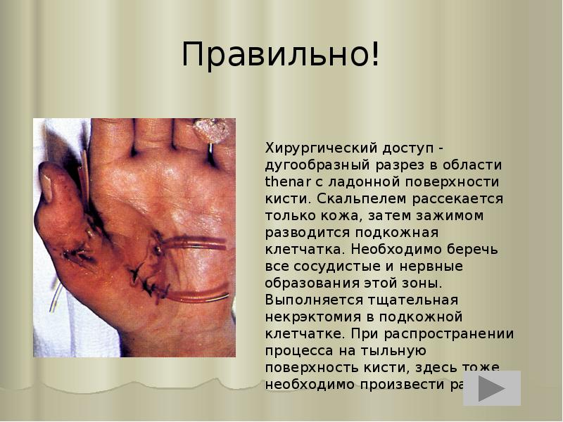 Правильно! Правильно!