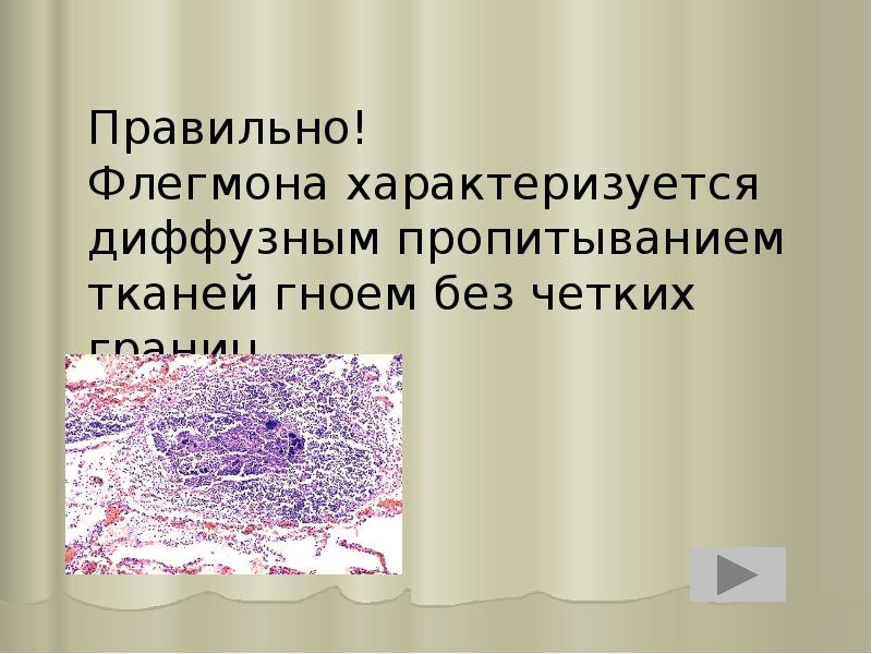 Правильно! Флегмона характеризуется диффузным пропитыванием тканей гноем без четких границ Правильно! Флегмона характеризуется диффузным пропитыванием тканей гноем без четких границ