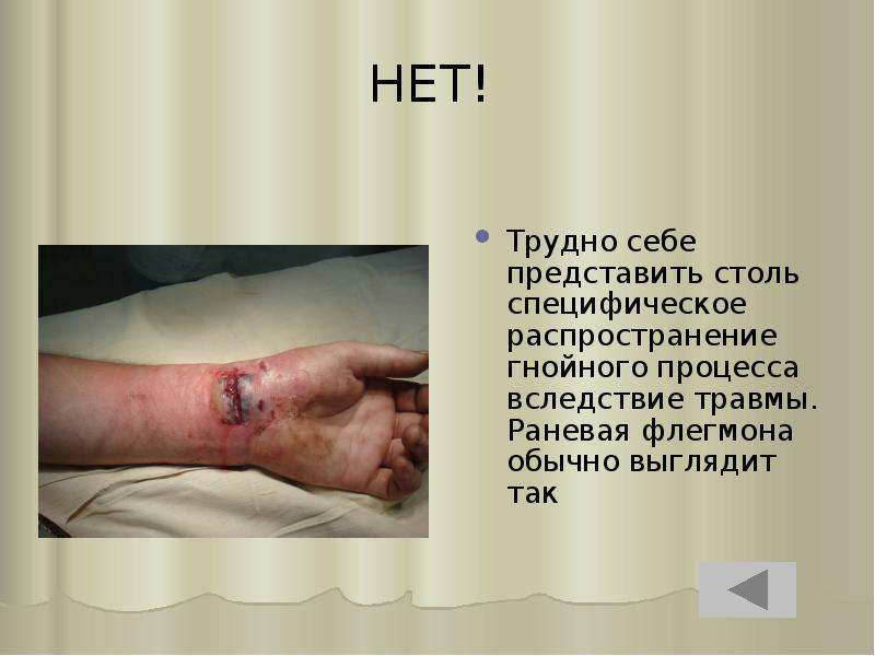 НЕТ!
Трудно себе представить столь специфическое распространение гнойного процесса вследствие НЕТ!
Трудно себе представить столь специфическое распространение гнойного процесса вследствие