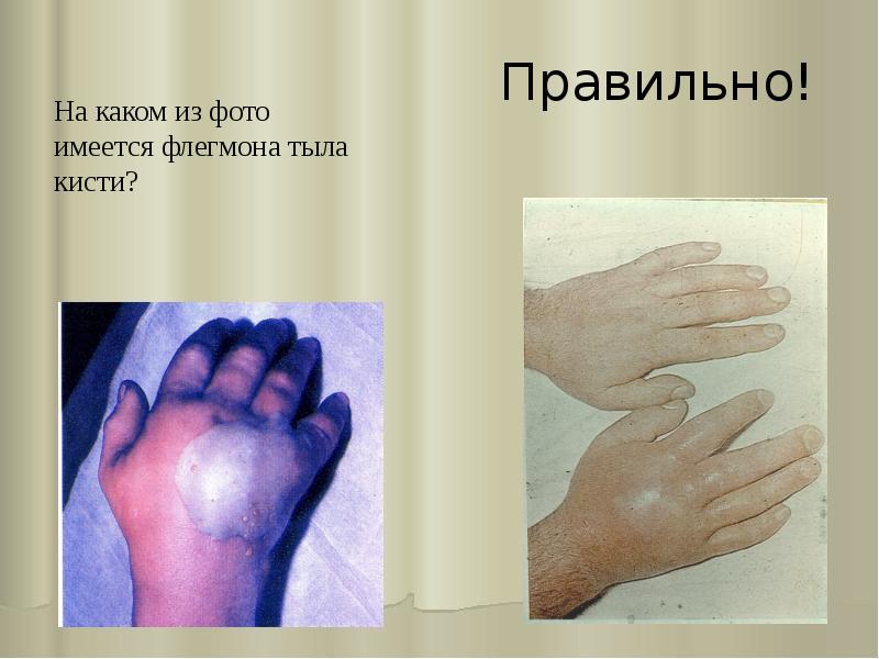 Правильно! Правильно!