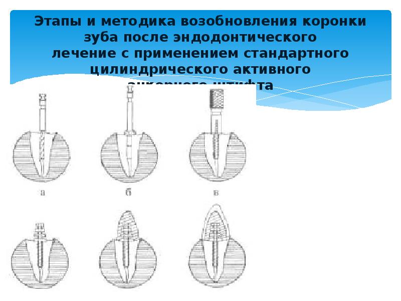 Эндодонтическое лечение презентация