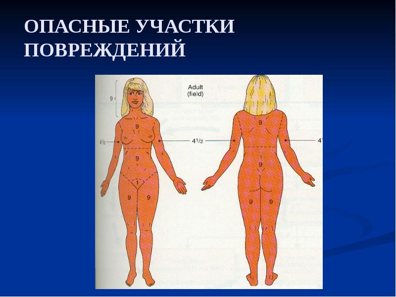 ОПАСНЫЕ УЧАСТКИ ПОВРЕЖДЕНИЙ ОПАСНЫЕ УЧАСТКИ ПОВРЕЖДЕНИЙ