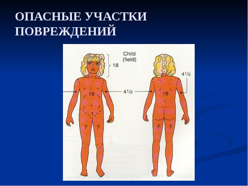 ОПАСНЫЕ УЧАСТКИ ПОВРЕЖДЕНИЙ ОПАСНЫЕ УЧАСТКИ ПОВРЕЖДЕНИЙ