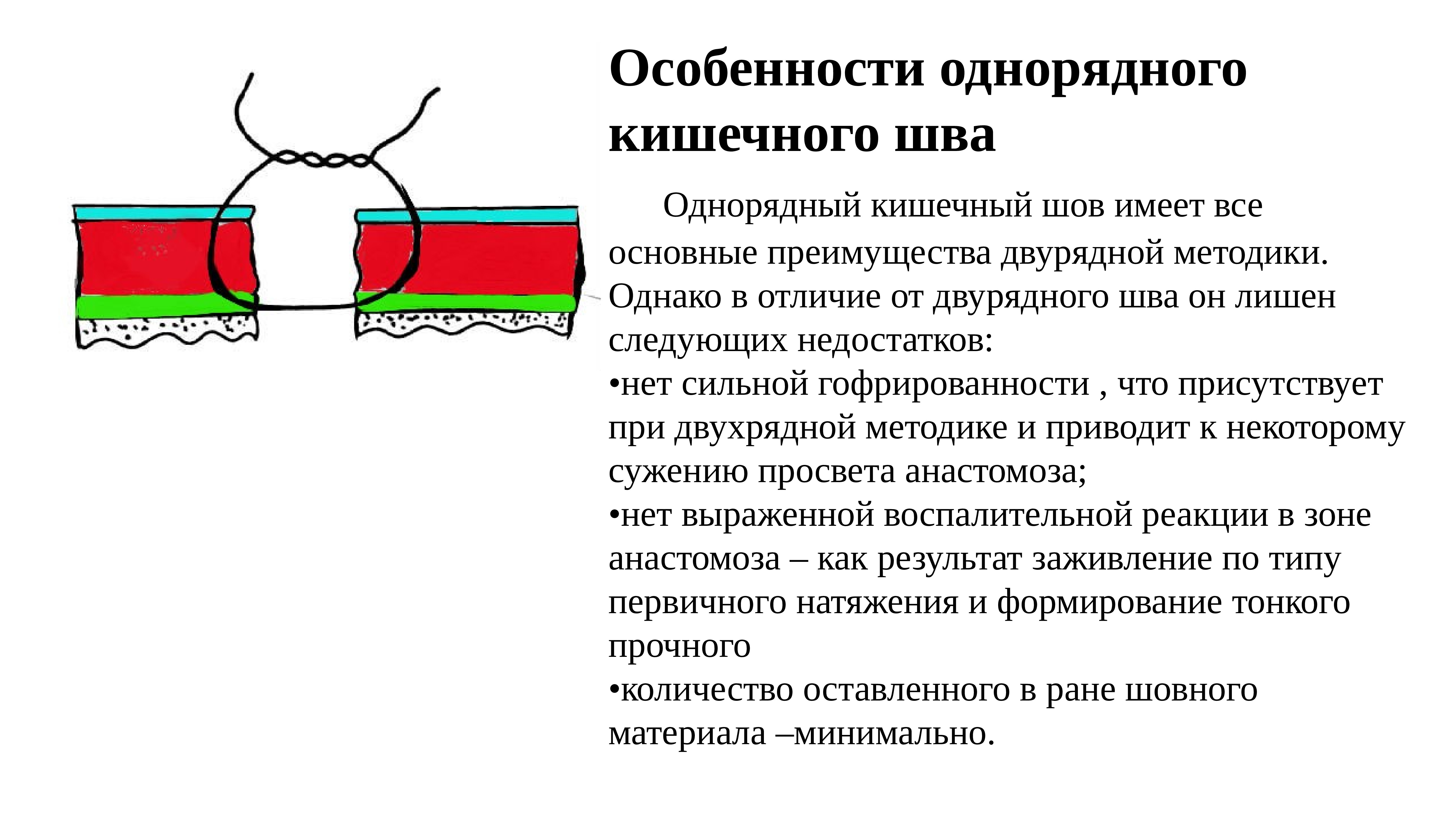 Кишечные швы. Однорядный и двухрядный кишечный шов. Однорядный непрерывный кишечный шов. Однорядный шов кишечника. Двухрядный шов.