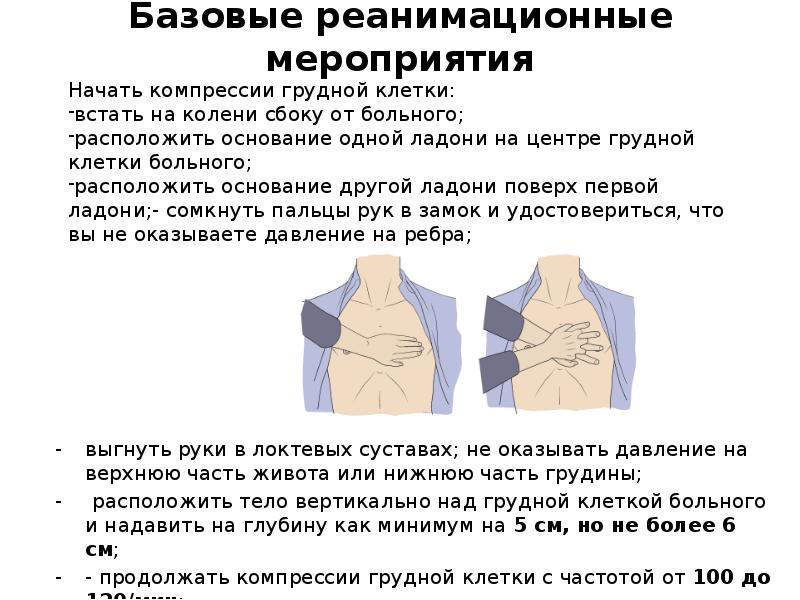 Компрессия грудной клетки. Давление в грудной клетке. Разрез грудной клетки при реанимационных мероприятиях. Нижняя часть грудной клетки больно нажимать. Болит верхняя часть грудной клетки.