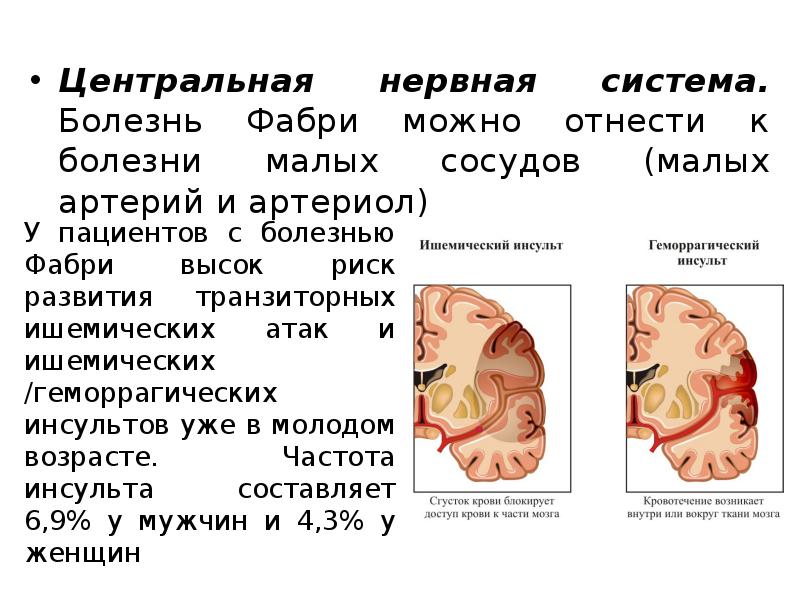 Меньше болезнь