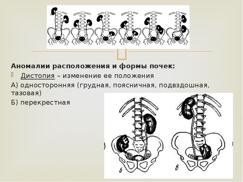 Рассмотрите изображенные на рисунках а и б дыхательные системы позвоночных животных