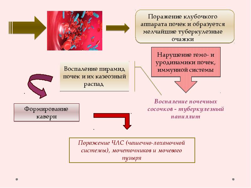 Презентация туберкулез мочевыделительной системы